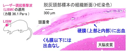 LISWを適用したラットの髄膜損傷